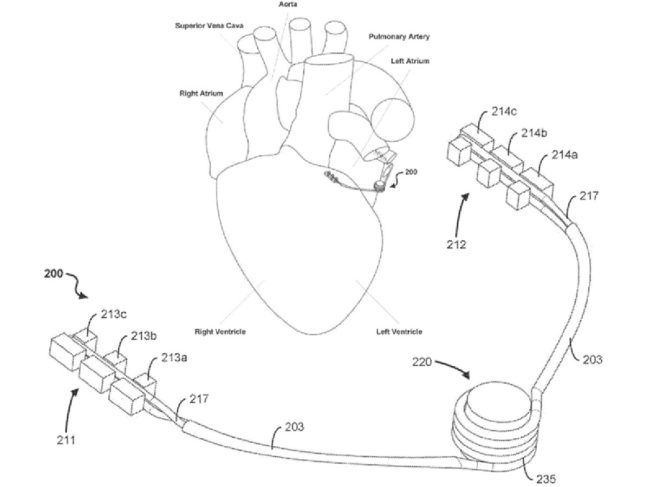 acoustic blood flow sensor